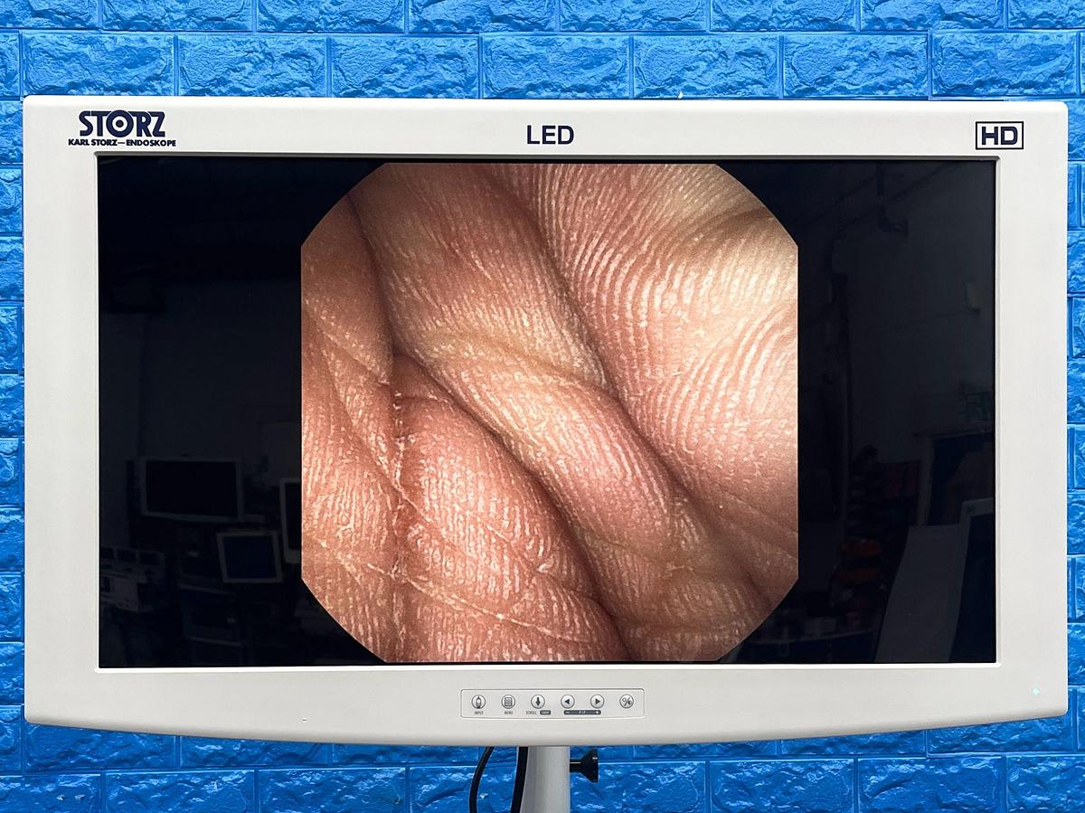 Used KARL STORZ Storz Scope, Model: 11272 VH