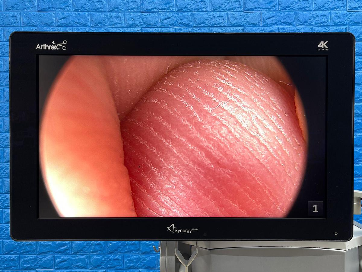 Used ARTHREX Synergy UHD4 4K Tower LED 4K Monitor 32 inch YOM: 2018