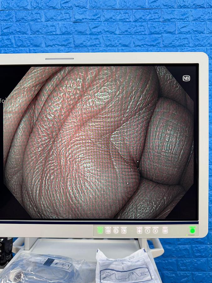 OLYMPUS-Evis-X1-CV-1500-Endoscopy-Tower 