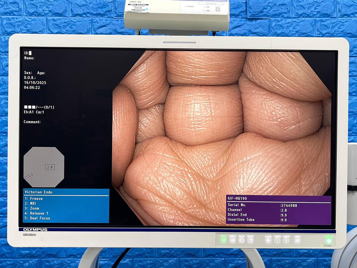 Used Olympus CV-190 with CLV-190 Endoscopy Tower 