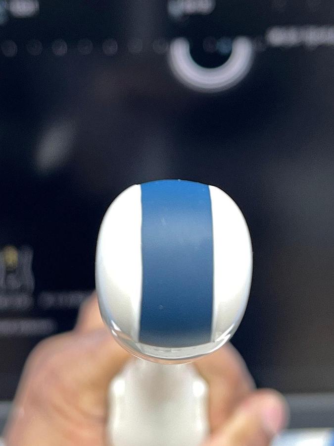 Used Hitachi Aloka Arietta V70 Ultrasound  YOM: 2016 With 5x Probes