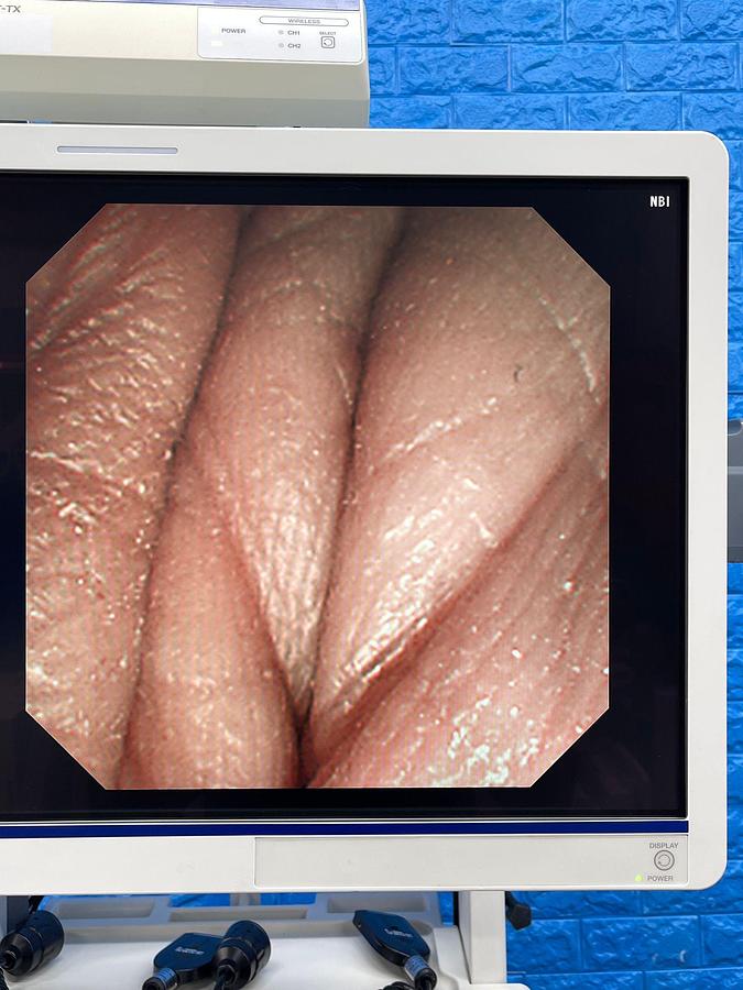 Used Olympus TFJ-260V Duodenoscope