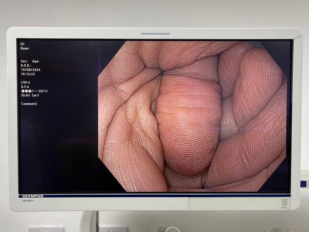 Used Olympus Scope Model: GIF- HQ190