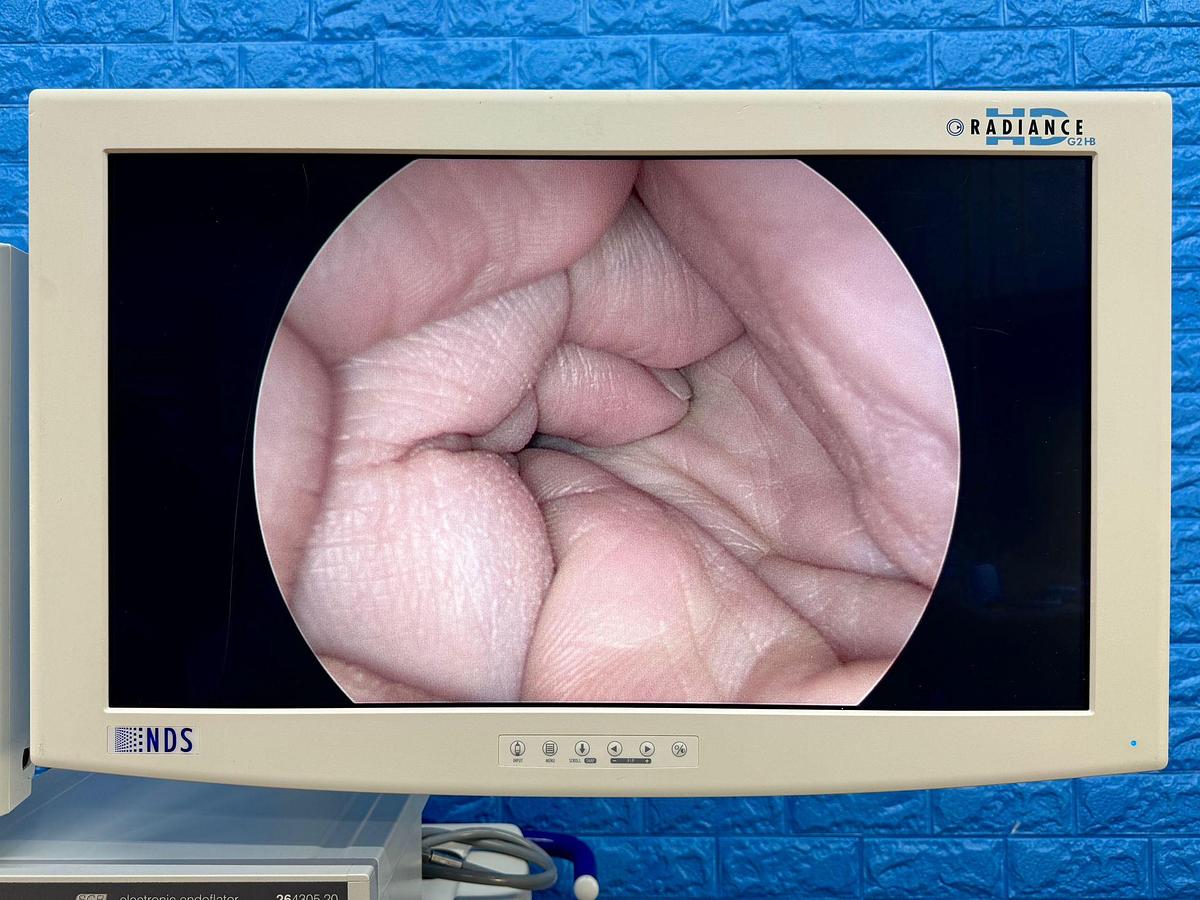 Used Karl Storz Spies Tower: -LCD Monitor 26 Inch  -Aida Monitor 19 Inch Touch Screen -Endoflator with Hose  -Keyboard -Camera Head H3-Z Spies S Full HD TH100  -Aida Control WD 200 -Xenon 300 Light source  -Spies S TC200/TC300 -Sony Printer