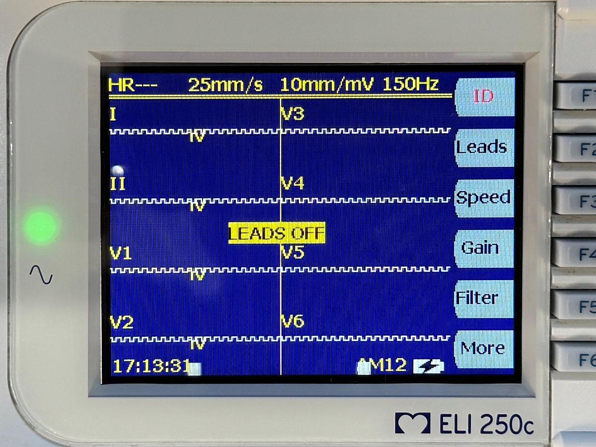 Used Mortara ELI 250c Electrocardiograph ECG REF: ELI250c-BCB-BAFAX 