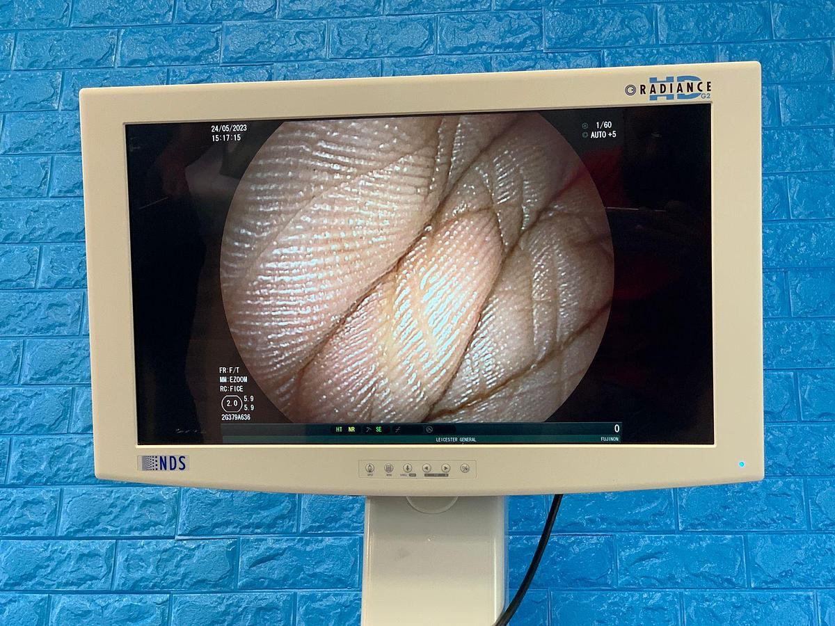 Used FUJINON EG-580NW