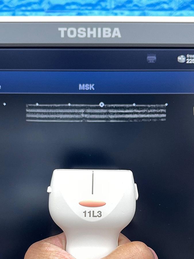 Used -Toshiba Ultrasound Aplio 500 YOM: 2015