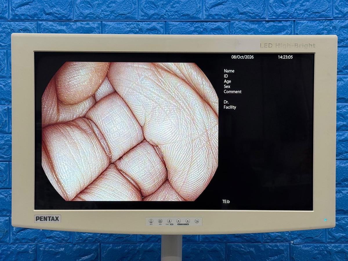 Used Pentax EPK-i7000 Complete Endoscopy Tower with Gastroscope & Colonoscope YOM 2013