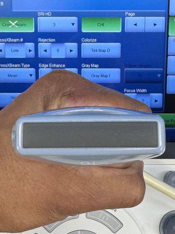 Used GE LOGIQ P9 YOM: 2016 R1 with Convex C1-5-RS YOM: 2022 and Linear Probe 9L-RS YOM: 2018