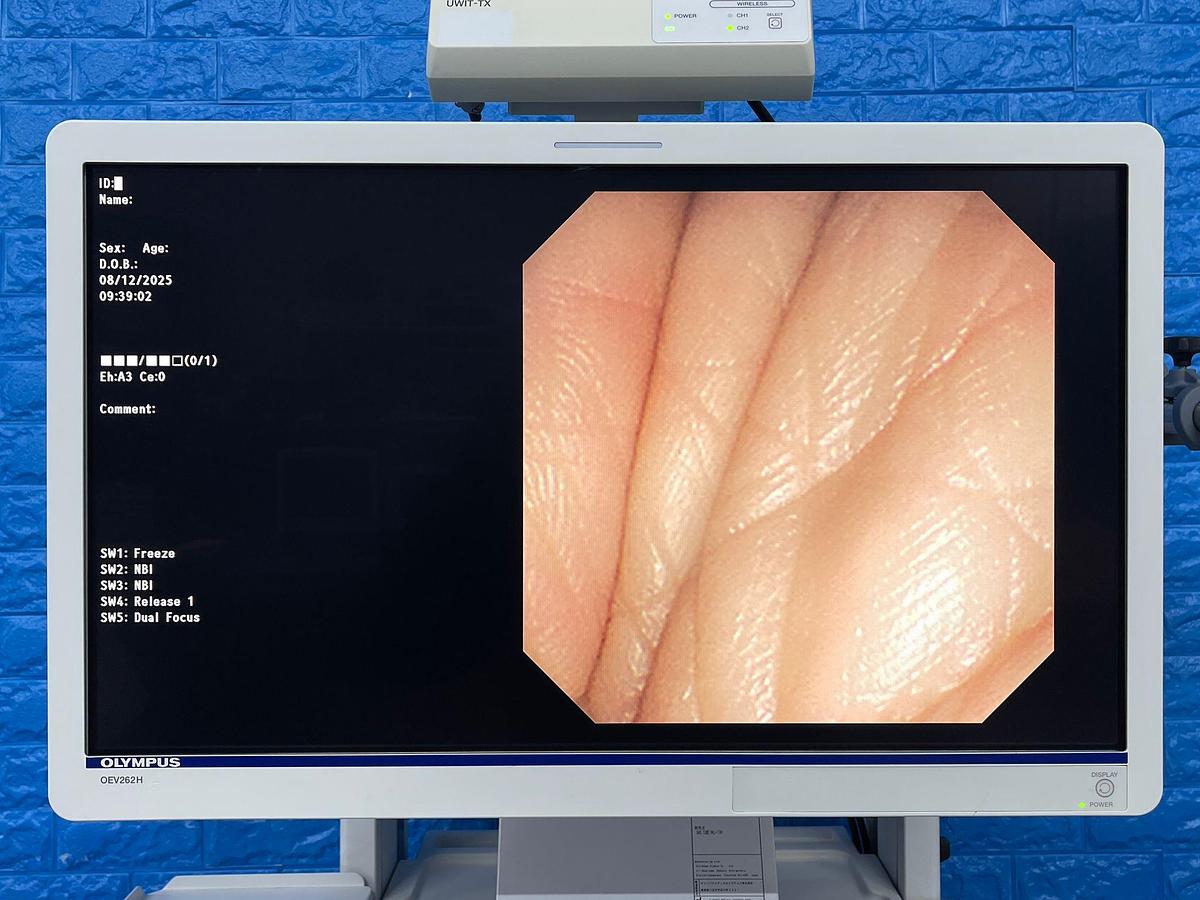 Used Olympus TJF-260V Duedenoscope