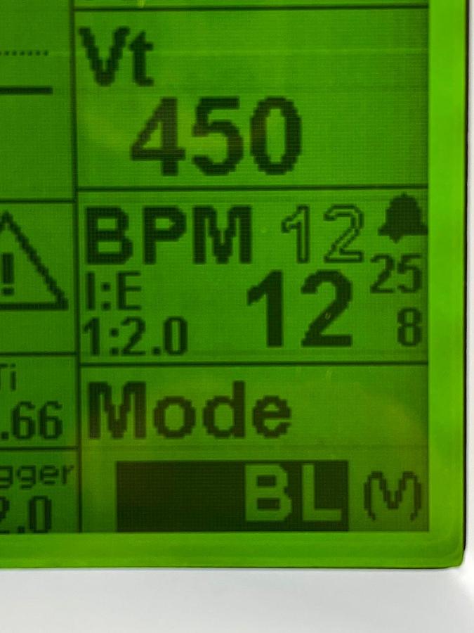 Used Zoll 731 Series Ventilator YOM: 2019 -4 pieces