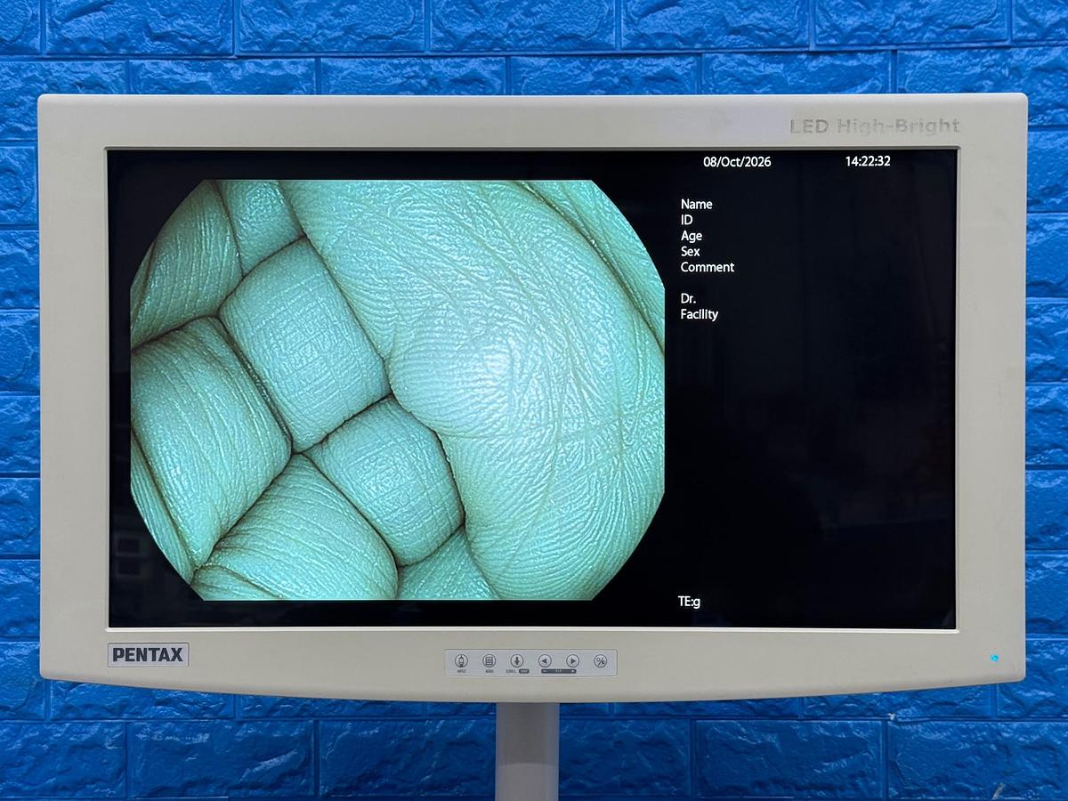 Used Pentax EPK-i7000 Complete Endoscopy Tower with Gastroscope & Colonoscope YOM 2013