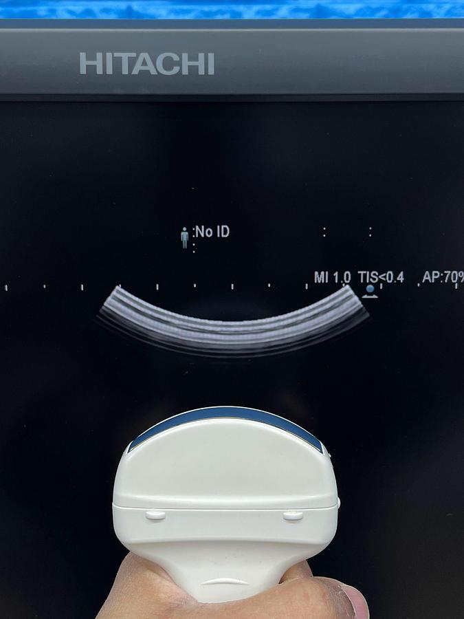 Used Hitachi Aloka Arietta V70 Ultrasound  YOM: 2016 With 5x Probes