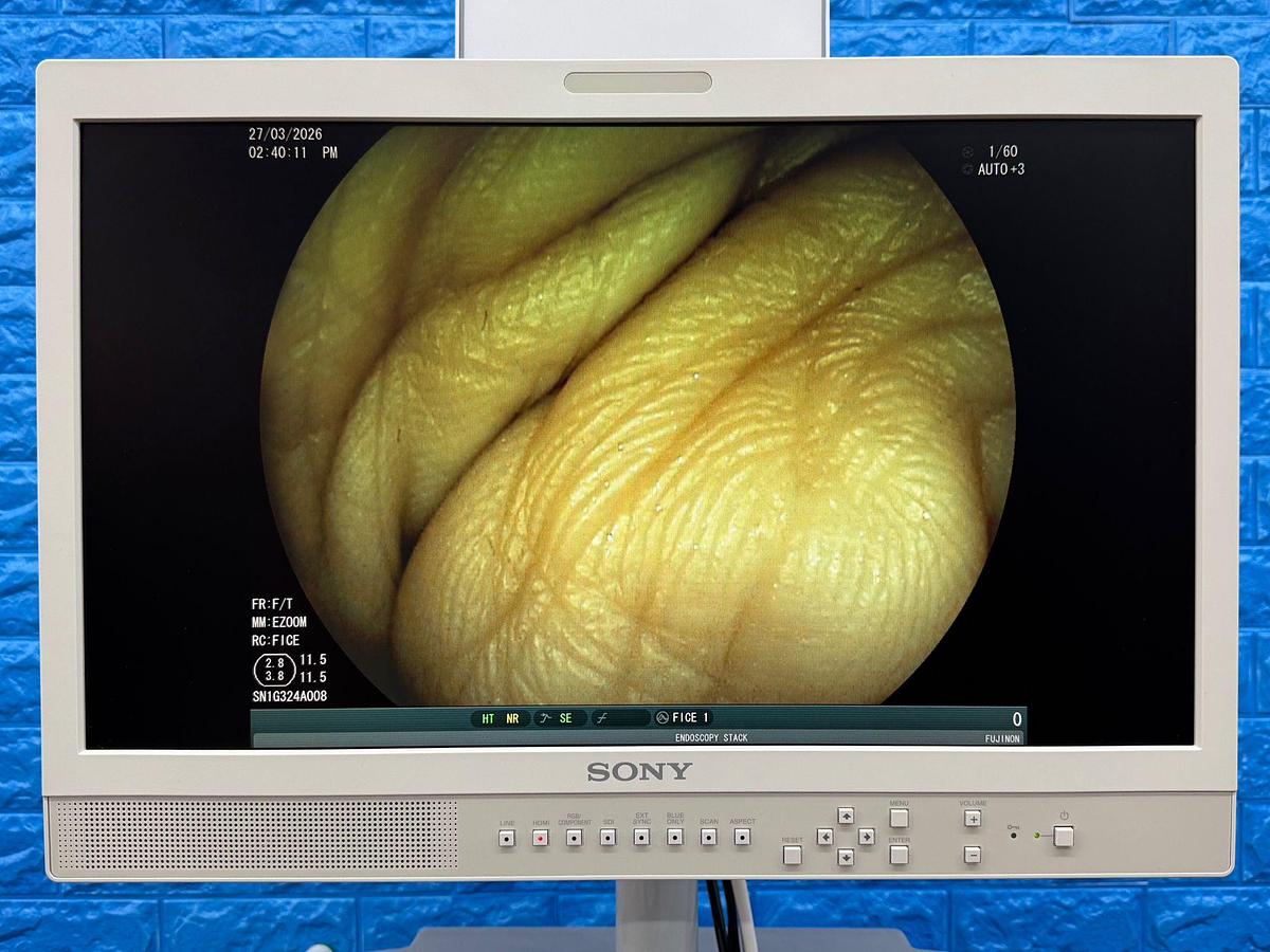 Used Fujinon Scope  Model: EG-530D 