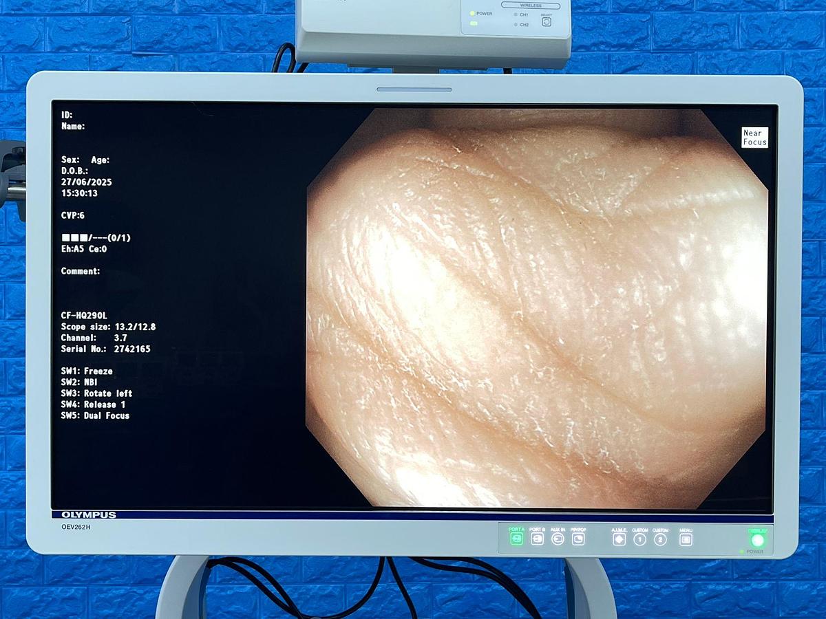 Used Olympus CF-HQ290L Colonoscope