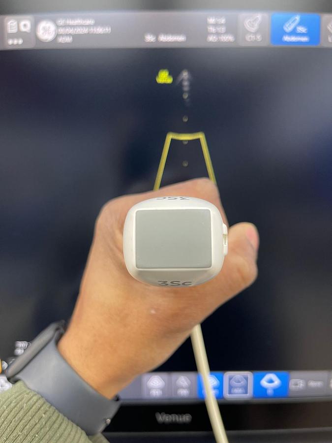 Used GE Venue YOM: 2018 With 3 Probes.