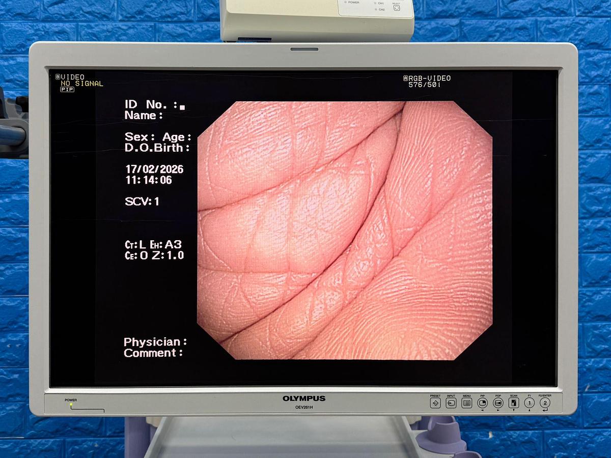 Used Olympus tower  Model : CV-260SL Scope Model : CF-H260DL HD colonoscope  Scope Model : GIF- H260 HD gastroscope  