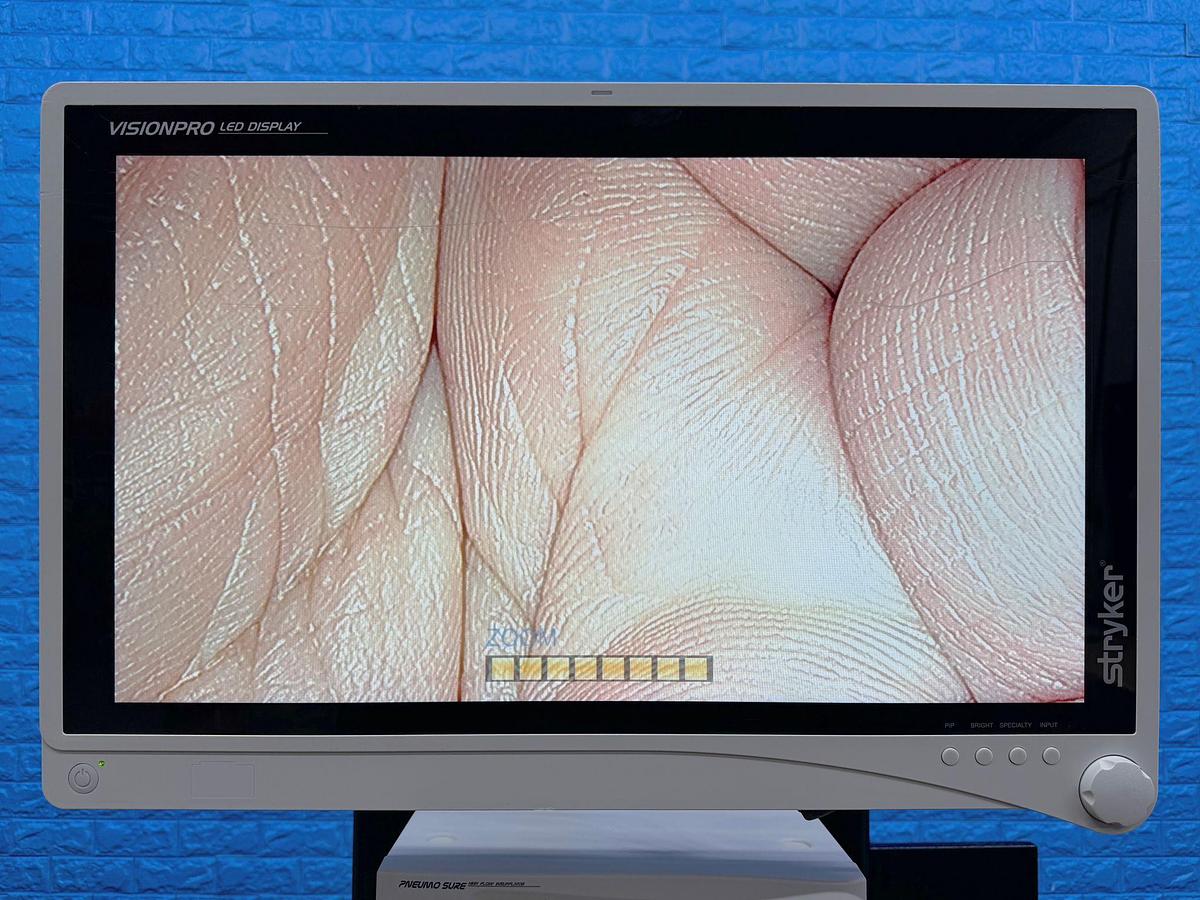 Used Stryker 1488 Stryker 1488 Processor  YOM: 2017 SN: 17E519814 Stryker L9000 LED Light Source  YOM: 2014 SN: 14G015694 Stryker 1488 Camera Head SN: 17L520714