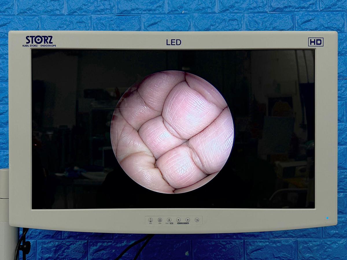 Used Stryker 4 mm 30° Ideal Eyes HD Autoclavable Arthroscope Optic REF: 0502-104-030