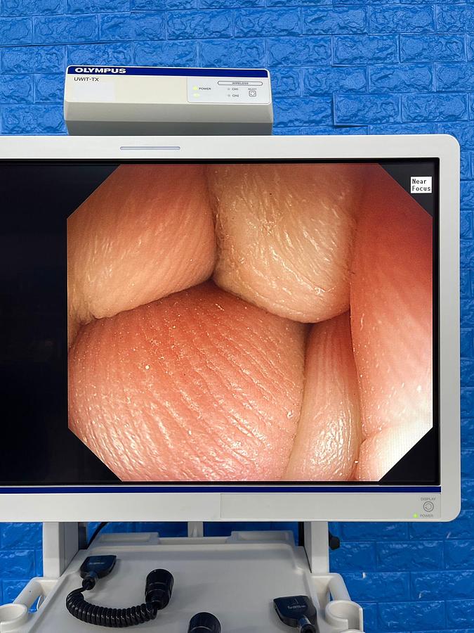 Used Olympus Scope Model: GIF -HQ290 