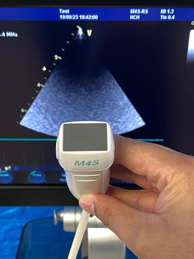 Used GE Vivid S6 Cardiovascular ultrasound system YOM: 2013