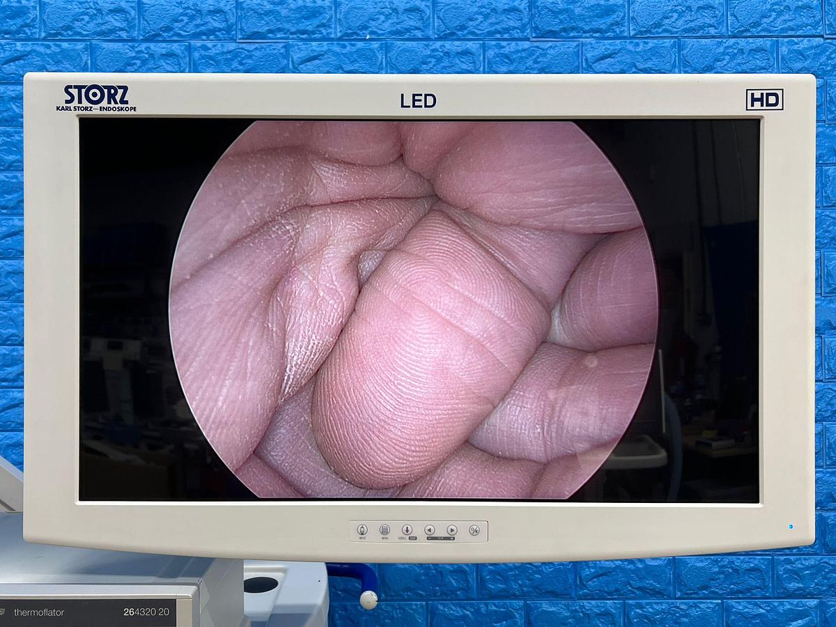 Used KARL STORZ Spies Tower Laparoscope