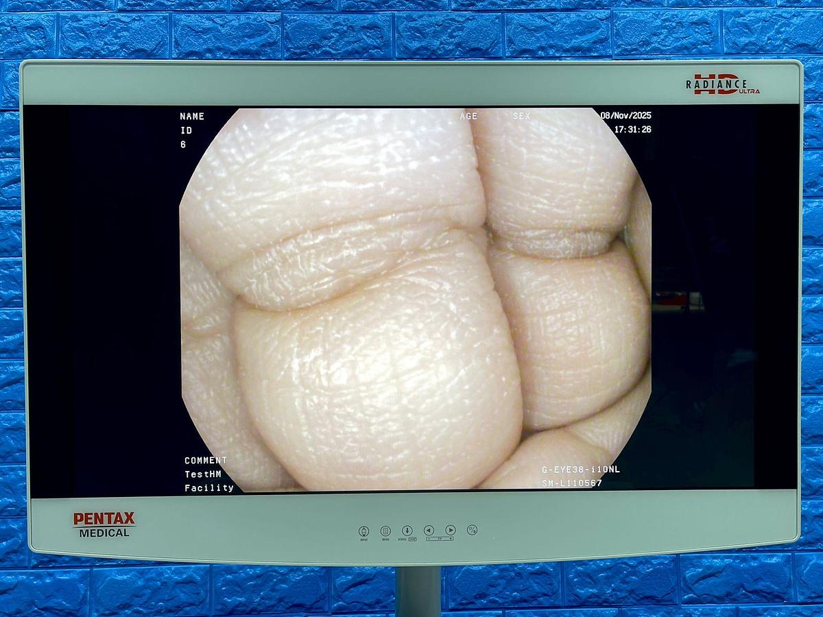 Used Pentax Scope Model: G-EYE38-i 10NL