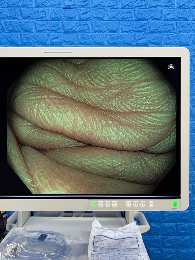 OLYMPUS-Evis-X1-CV-1500-Endoscopy-Tower 