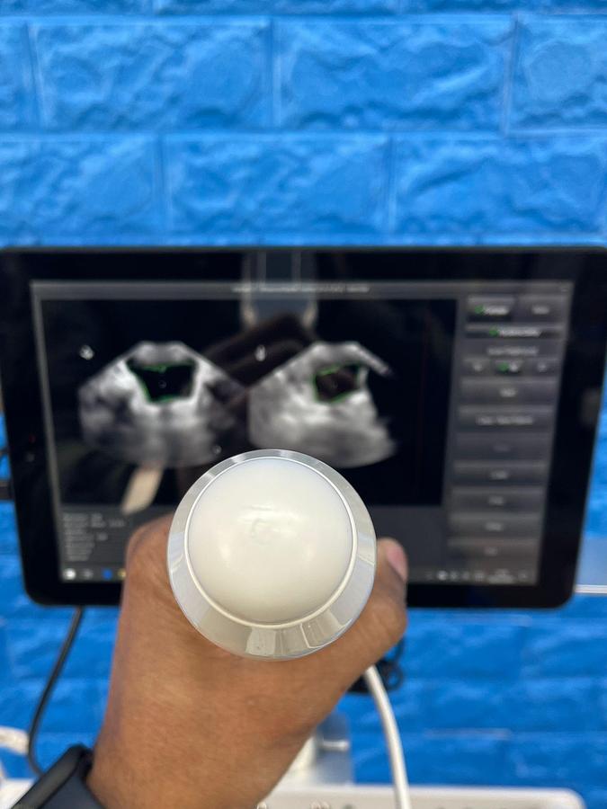 Used Vitacon VitaScan LT Urology Ultrasound With Vitascan V2 Probe.