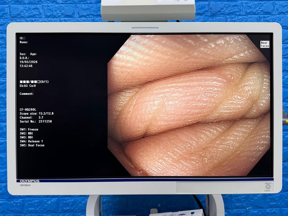 Used Olympus CF-HQ290L Colonoscope