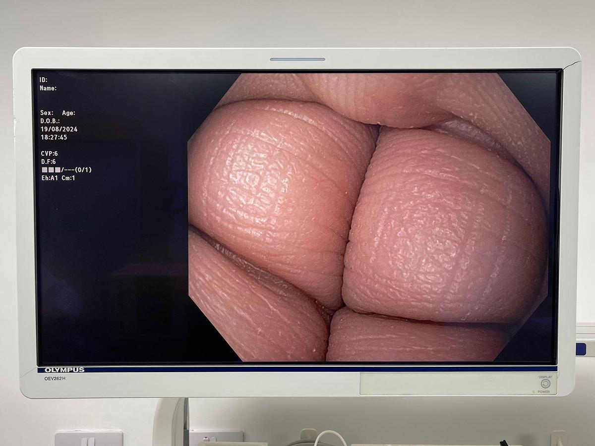 Used OLYMPUS Scope Model: GIF-HQ190 