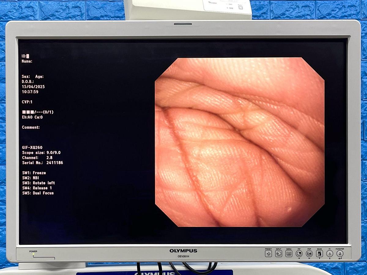 Used OLYMPUS Tower System CV-290 Endoscopy Processor