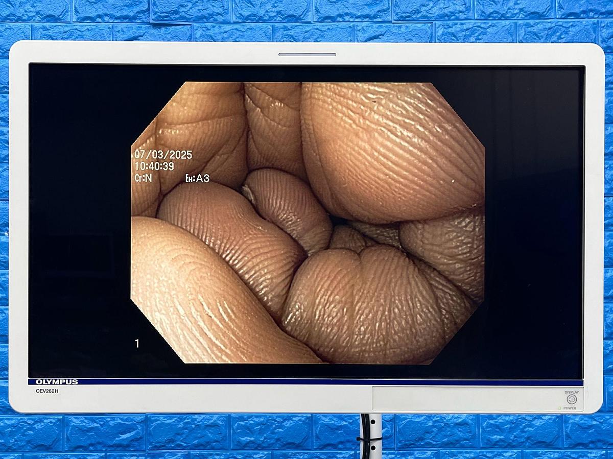 Used Olympus Scope Model: GIF-H180J