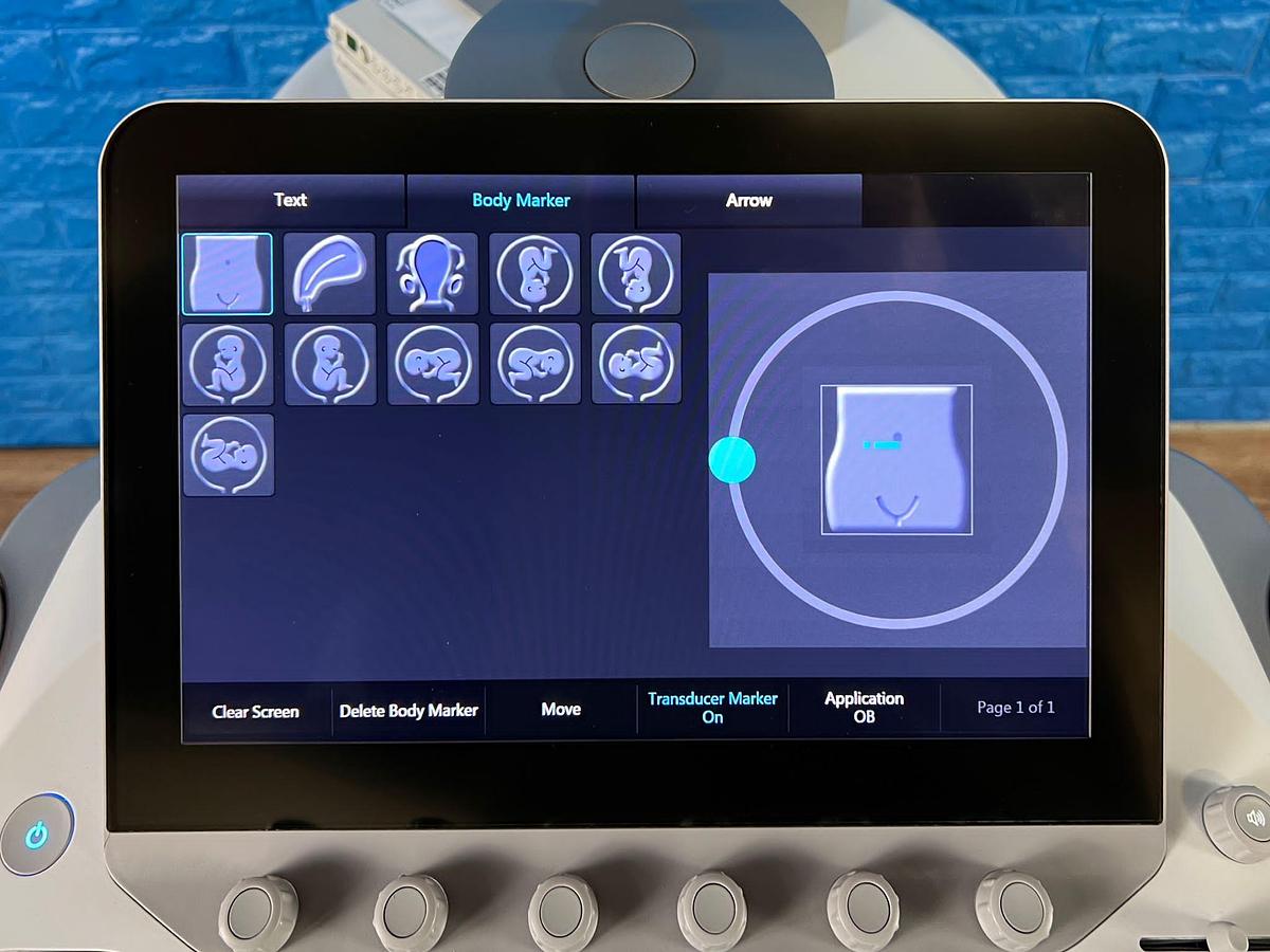 Used Siemens Acuson S1000 YOM: 2016