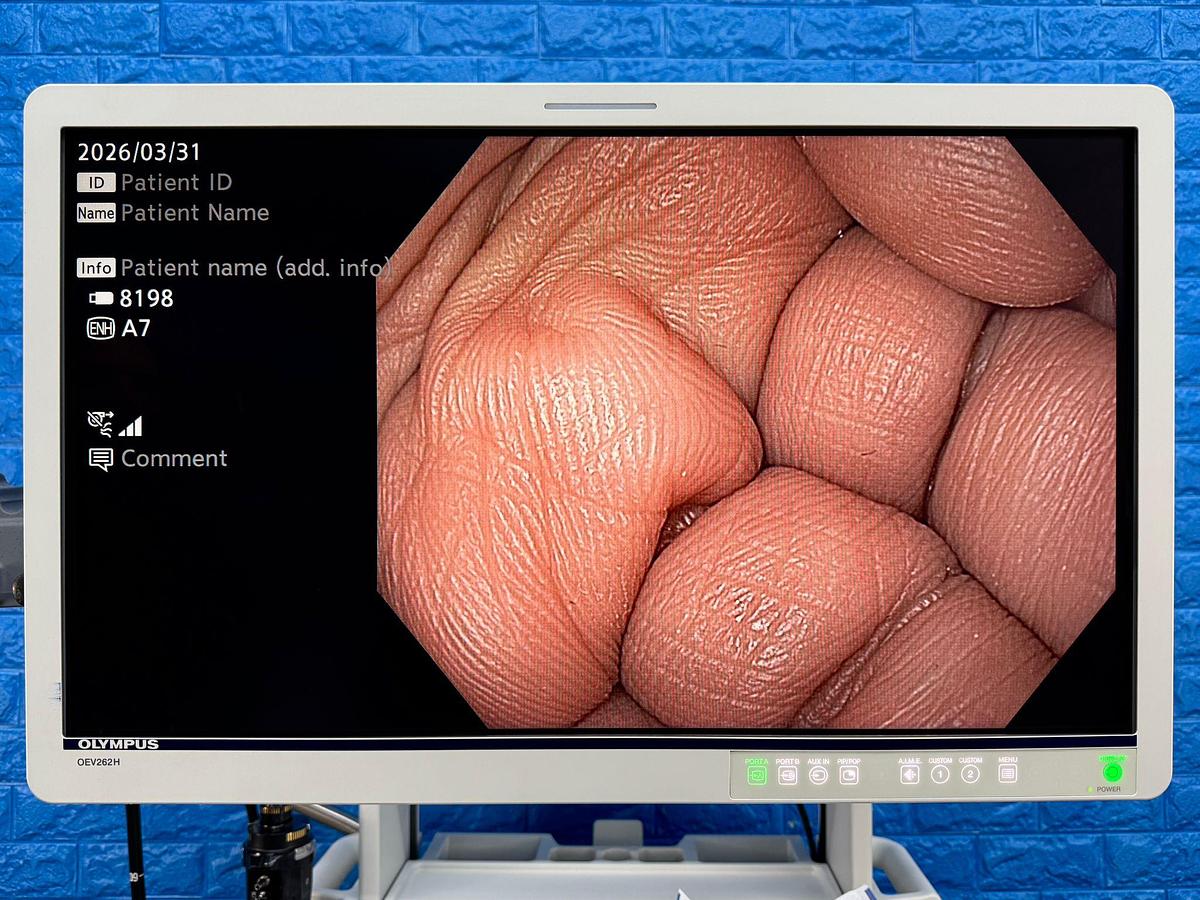 OLYMPUS-Evis-X1-CV-1500-Endoscopy-Tower 