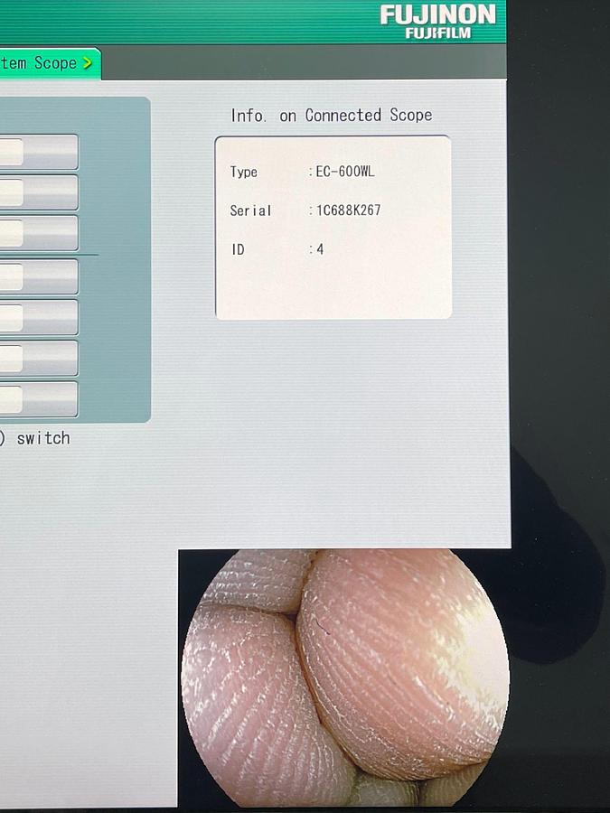 Used FUJINON Scope Model: EC-600WL