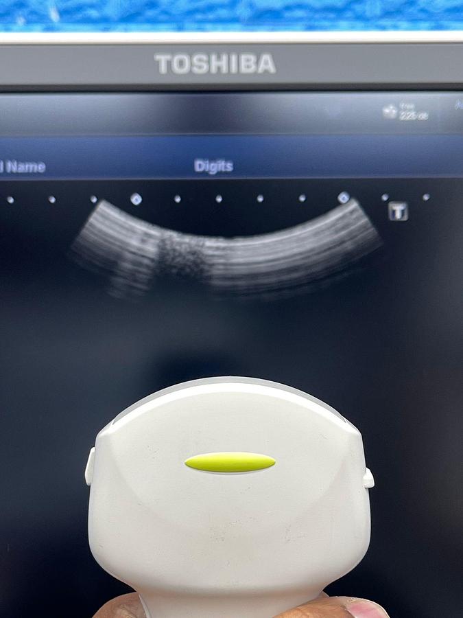 Used Toshiba Ultrasound Aplio 500 YOM: 2015