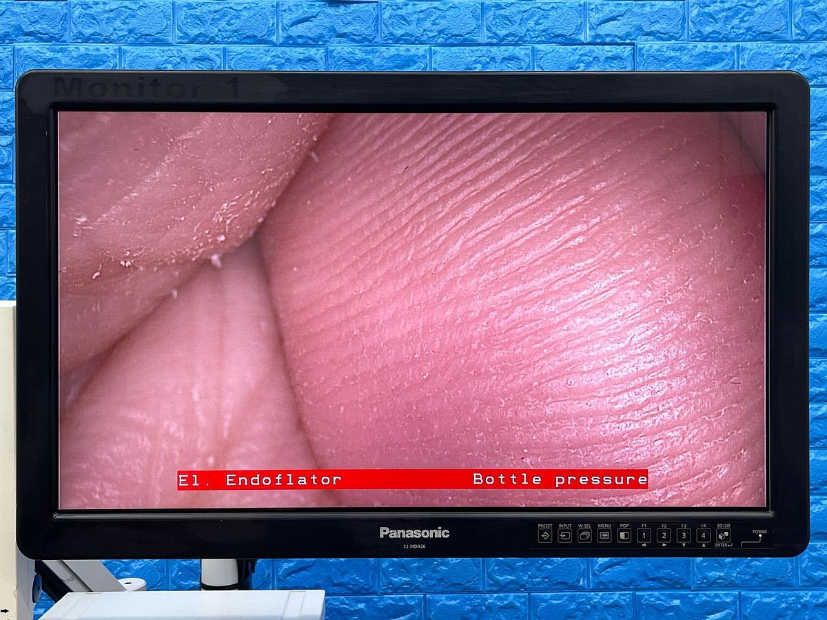 Used Karl Storz Tower