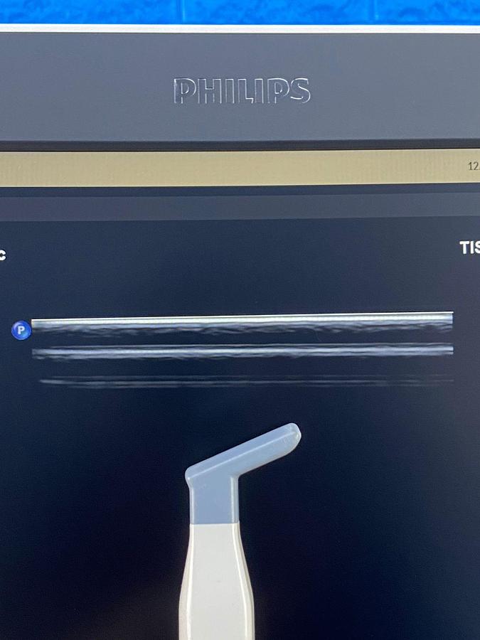 Used Philips Affiniti 70G PureWave Software Version: 9.0.16 Hardware B.0 YOM: 2018 Probes L15-7io C10-3v C9-2 C5-1