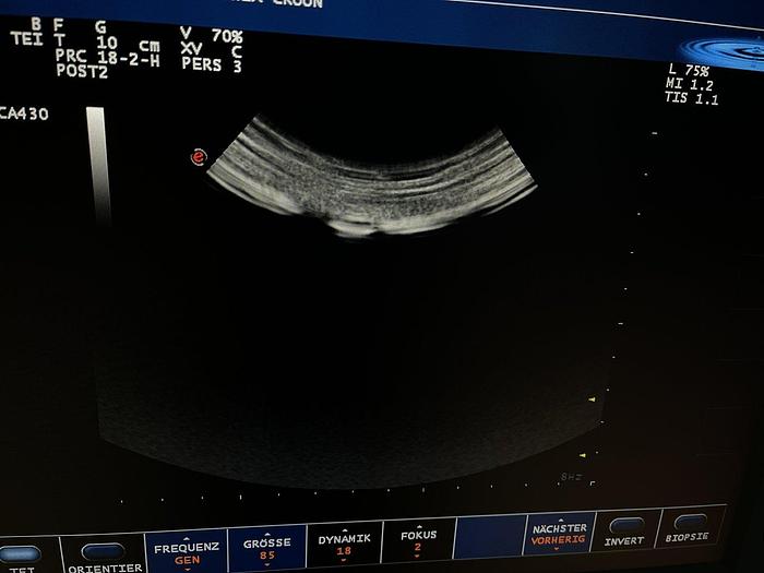 Gebraucht eSaote Ultraschallsonde Konvex CA430E