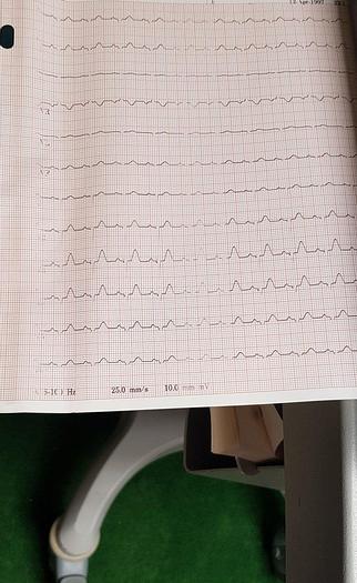 Gebraucht GE MAC 5500 EKG System auf Trollley