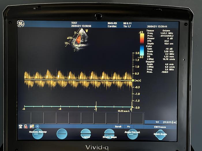 Gebraucht GE Vivid q Ultraschallgerät auf Vivid i Trolley mit 2 Sonden und EKG Kabel