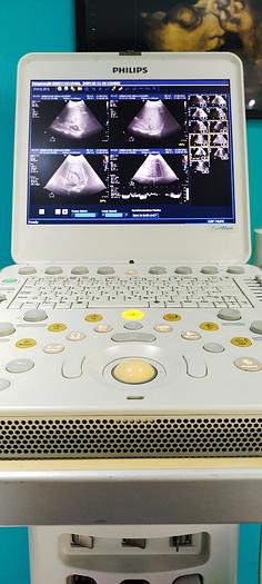 Gebraucht Philips CX50 tragbare Ultraschallgerät auf Philips CX Wagen inkl. Netzteil
