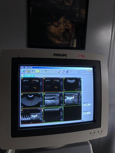 Gebraucht Philips HD11 Ultraschallgerät mit 3x Sonden, Sony Drucker UP-D895MD