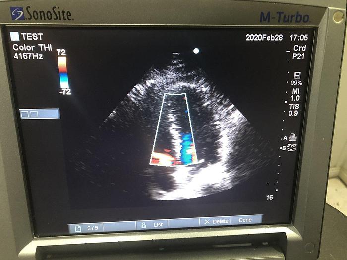Gebraucht SonoSite M-turbo tragbare Ultraschallsystem auf Trolley mit 3xSonden