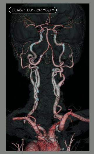 Used 2018 General Electric (GE) Optima CT660