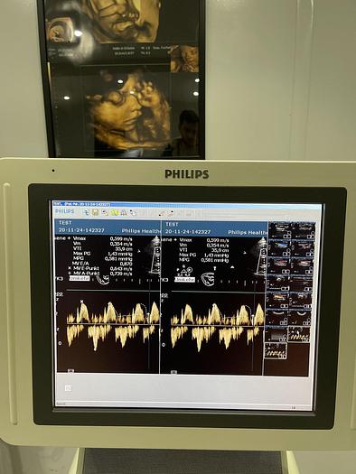 Gebraucht Philips HD 11 XE Ultraschallgerät mit 5x Sonden