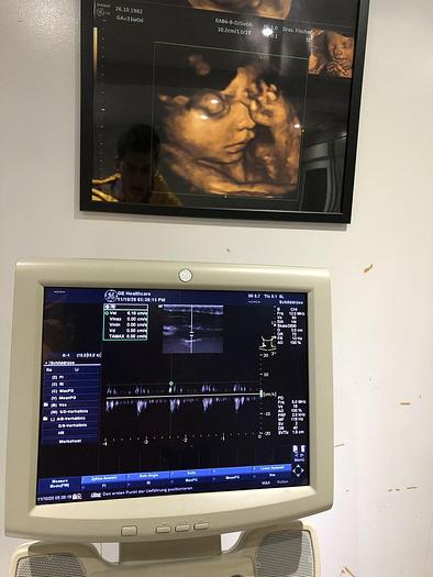 Gebraucht GE LOGIQ A5 Ultraschallgerät mit 2x Sonden und