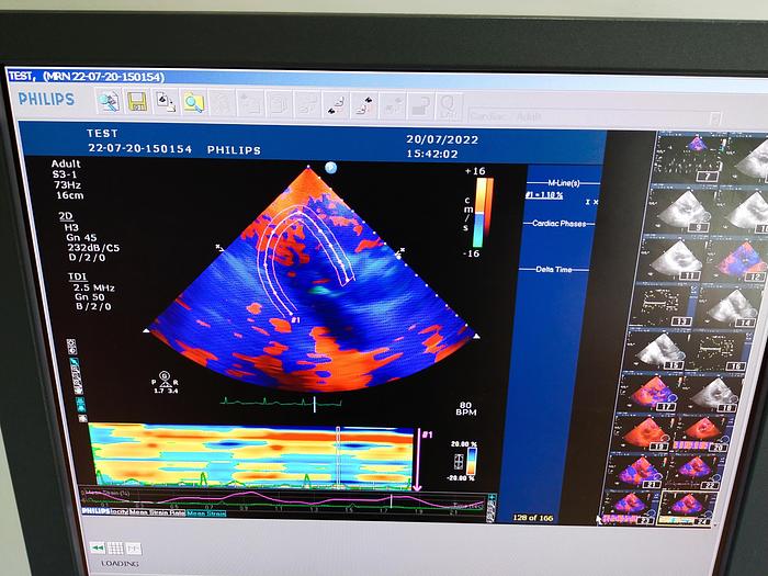 Gebraucht Philips HD11XE Ultraschallgerät mit drei Sonden, Drucker und Video Kassette Recorder S/V 2.0.8
