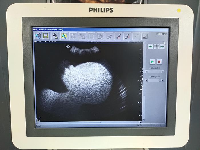 Gebraucht Philips HD7 diagnostik Ultraschallsystem mit DVD Brenner ohne Drucker SW 1.1